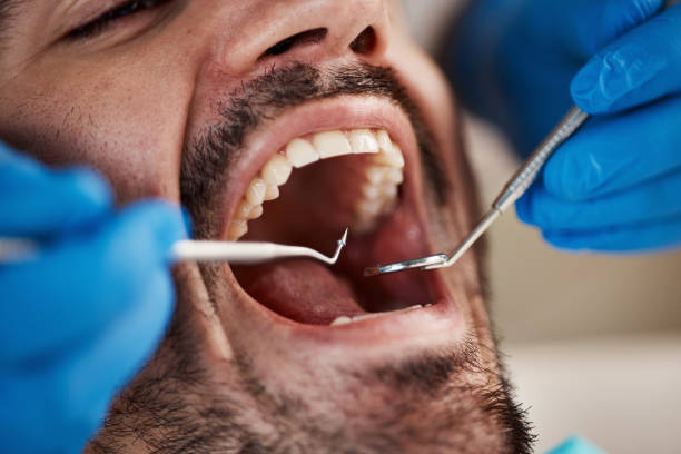Best Emergency Dental Care for Broken or Chipped Teeth in Stiles, PA